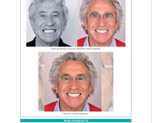 Publicación en Gaceta Dental de "Tratamiento Multidisciplinar" por Jesús Creagh.
