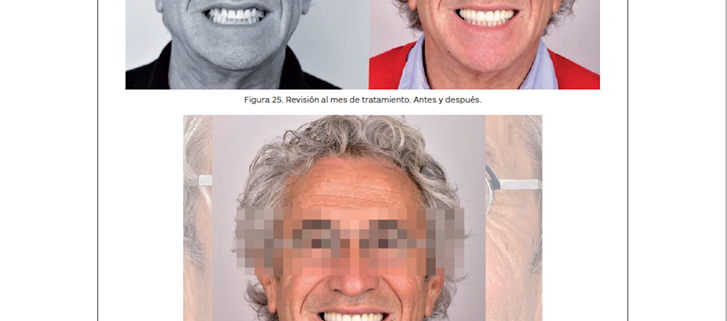 Publicación en Gaceta Dental de "Tratamiento Multidisciplinar" por Jesús Creagh.